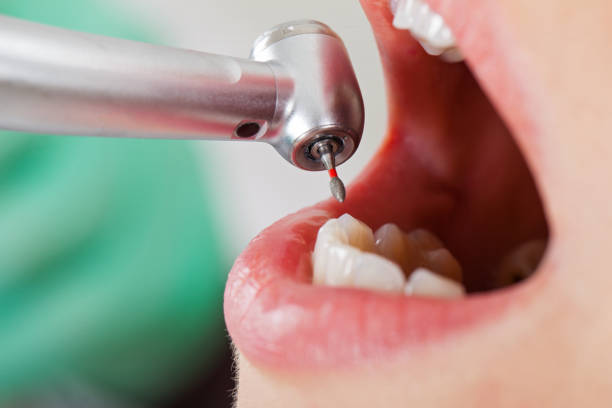 Best Emergency Tooth Extraction in Brookside Village, TX